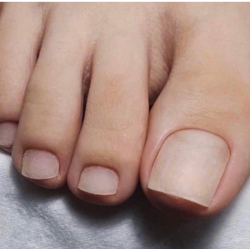 Женские пальцы ног без лака