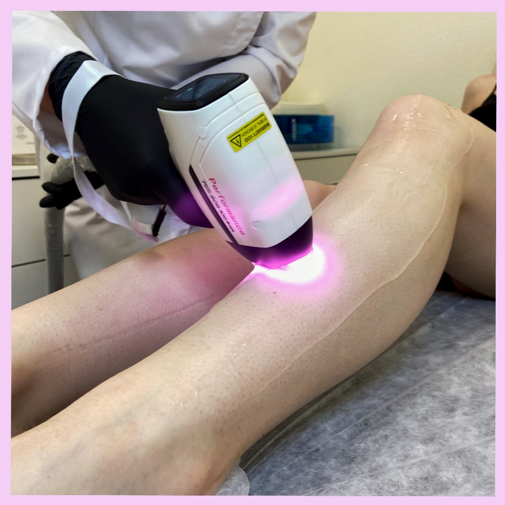 ..Лазер комплекс MINI ( бикини тотальное, подмышки )