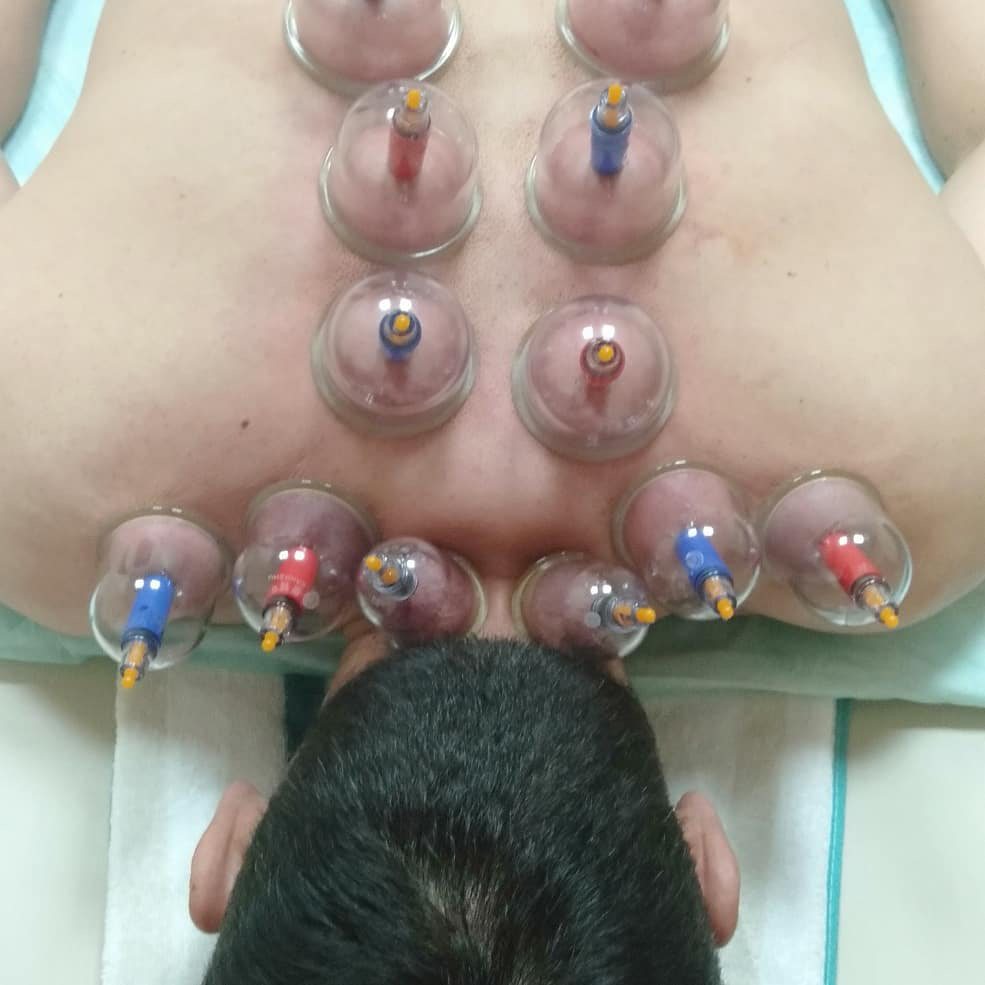 Баночный (вакуумный) массаж