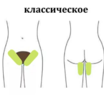 Бикини классическое