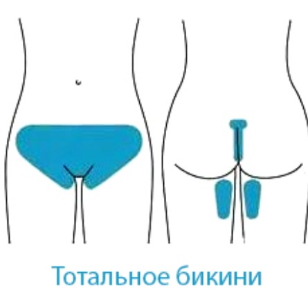 Бикини тотальное