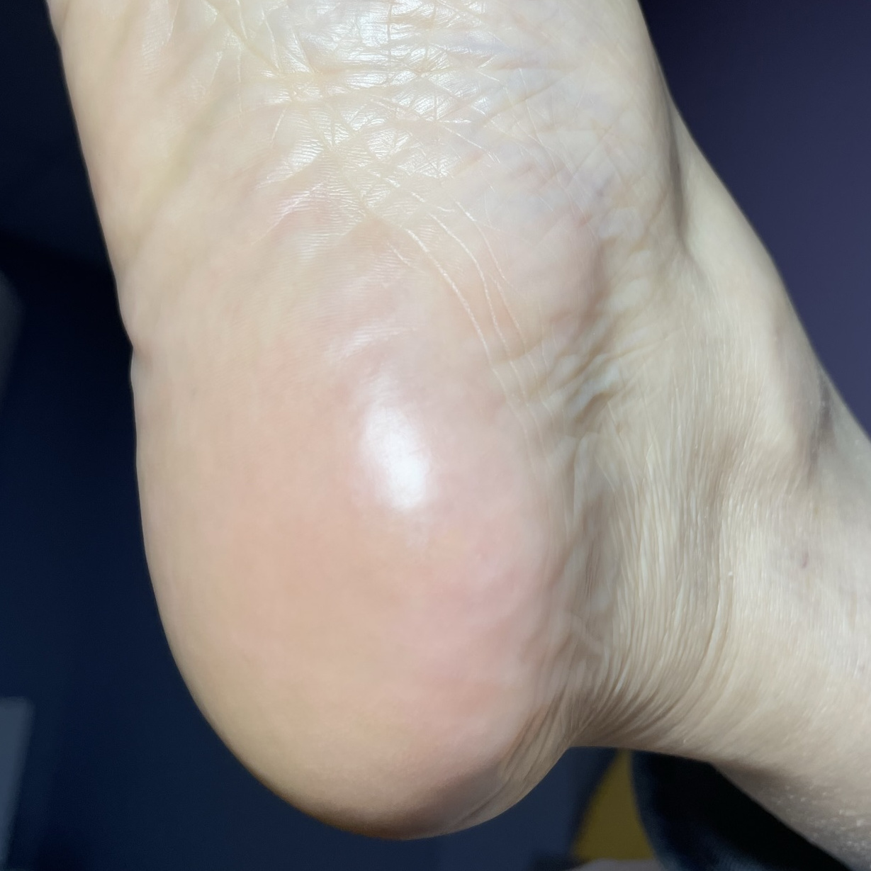 Smart педикюр гигиенический