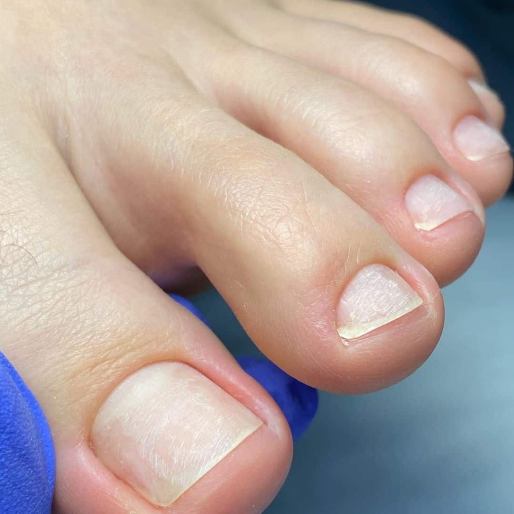 Гигиенический педикюр, без покрытия