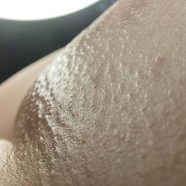 депиляция "глубокое бикини"