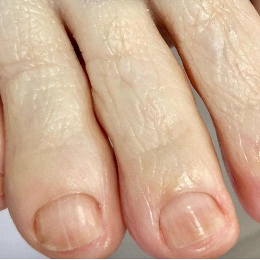 Обработка пальцев ног