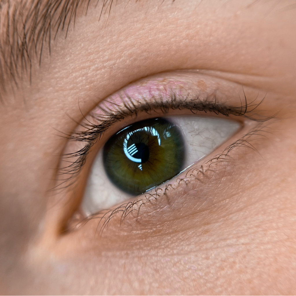 Межресничка