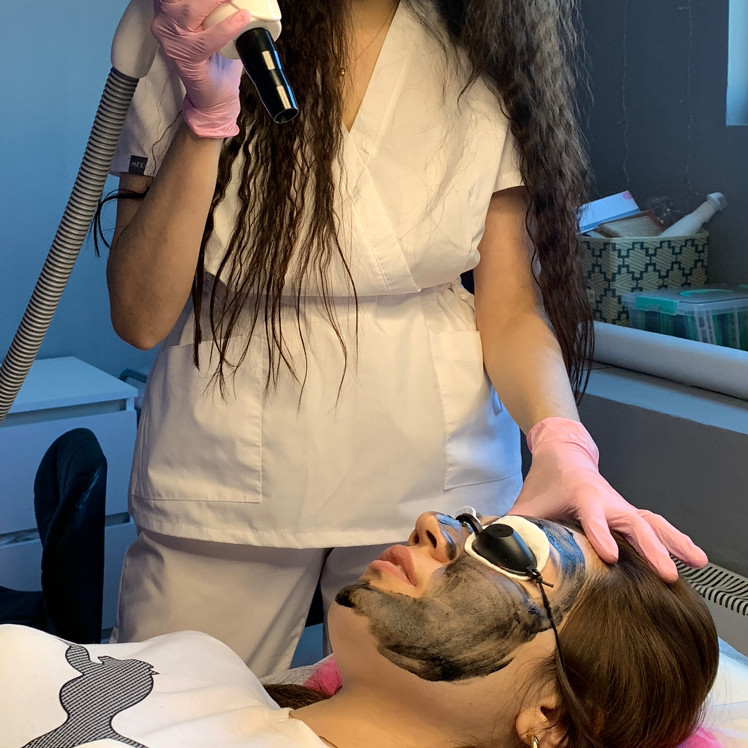 Карбоновый пилинг