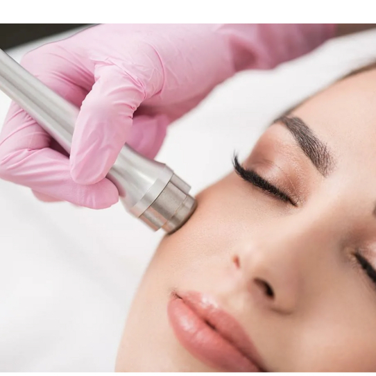 Микродермобразия  ( механическая шлифовка + маска или LED)