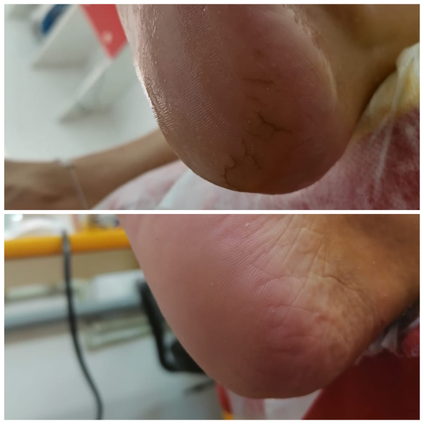 Педикюр полностью( без покрытия )