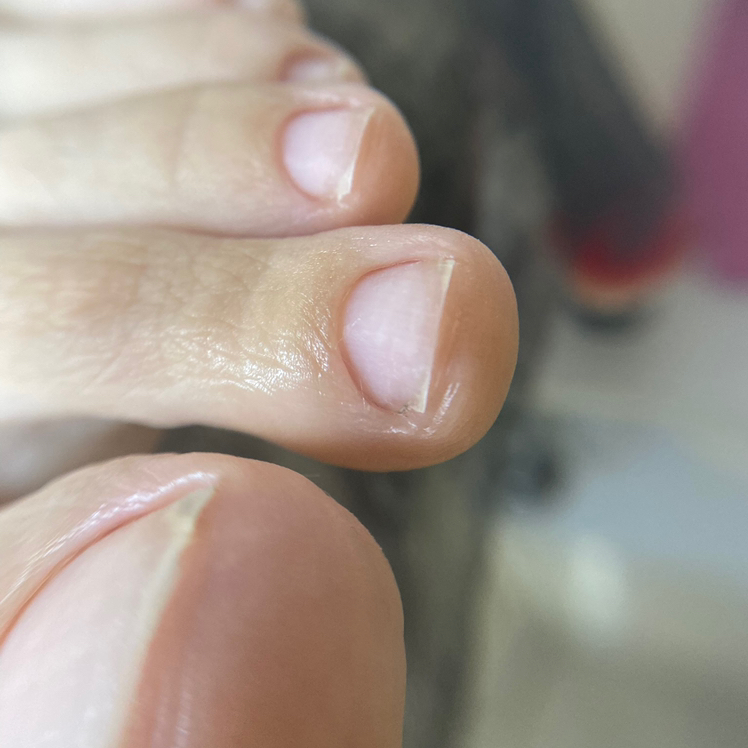 Педикюр гигиенический (обработка пальчиков и стоп)