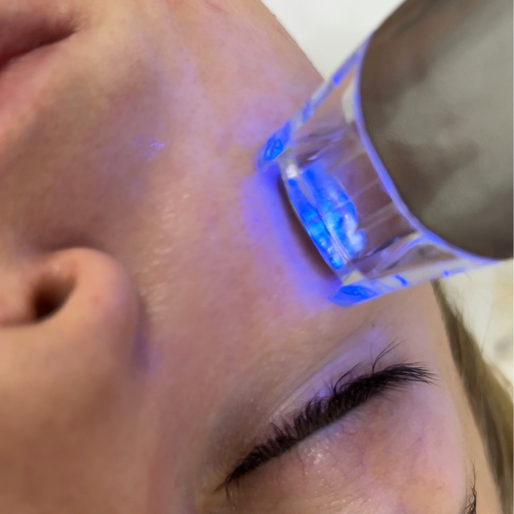 МИКРОТОКИ/биотоки лица