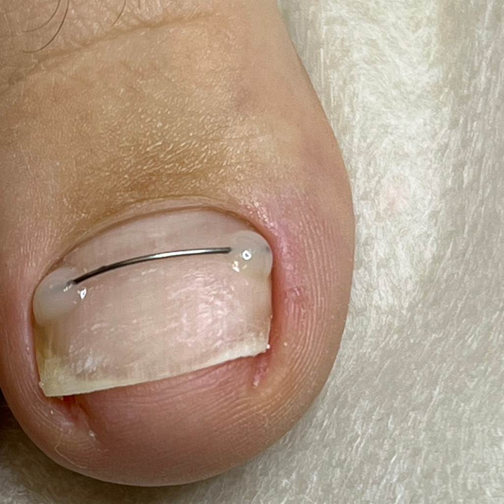 Установка Коррекционной Системы