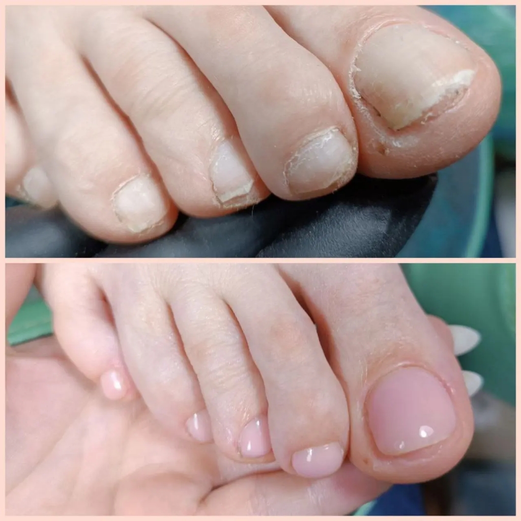 Педикюр Smart