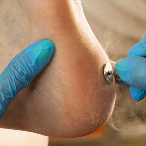 Педикюр гигиенический и Smart с обработкой стопы (без покрыти)