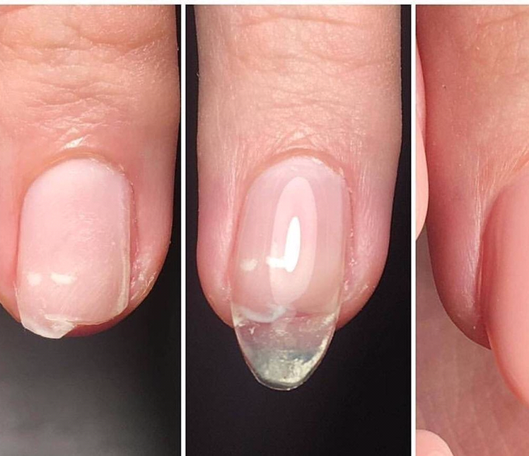 Ремонт ногтя ( как отдельная процедура)