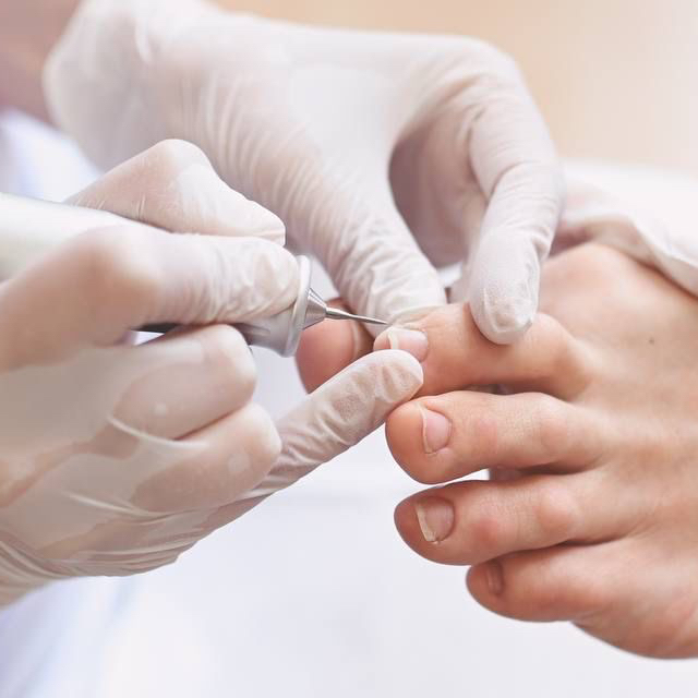 Обработка пальцев ног