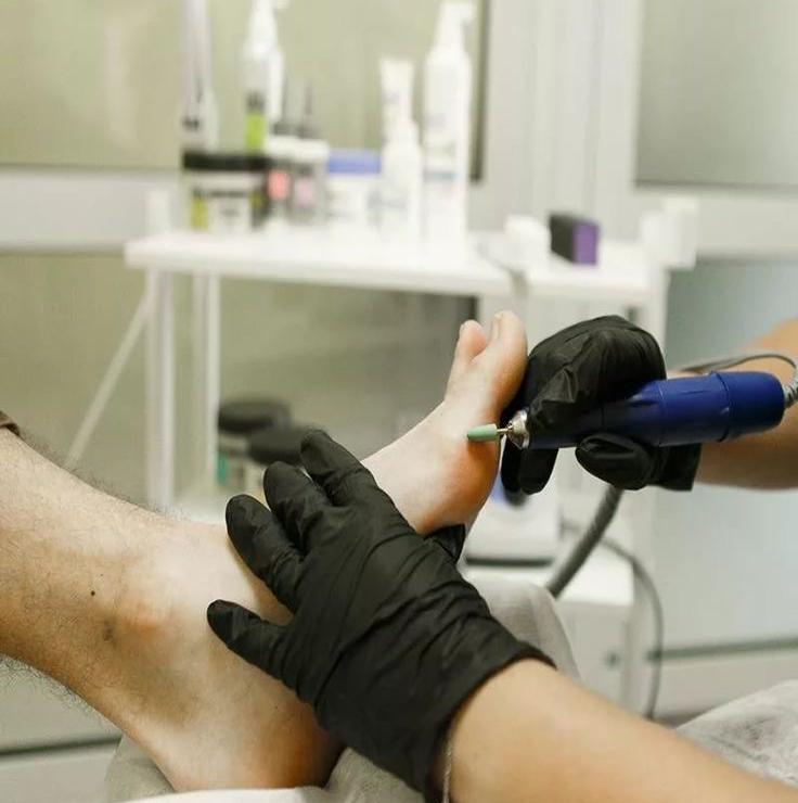 Педикюр мужской