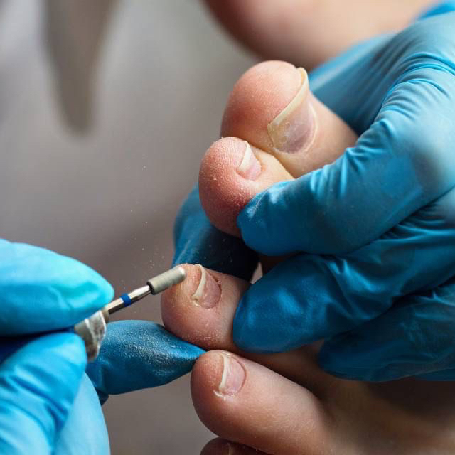 Педикюр подологический