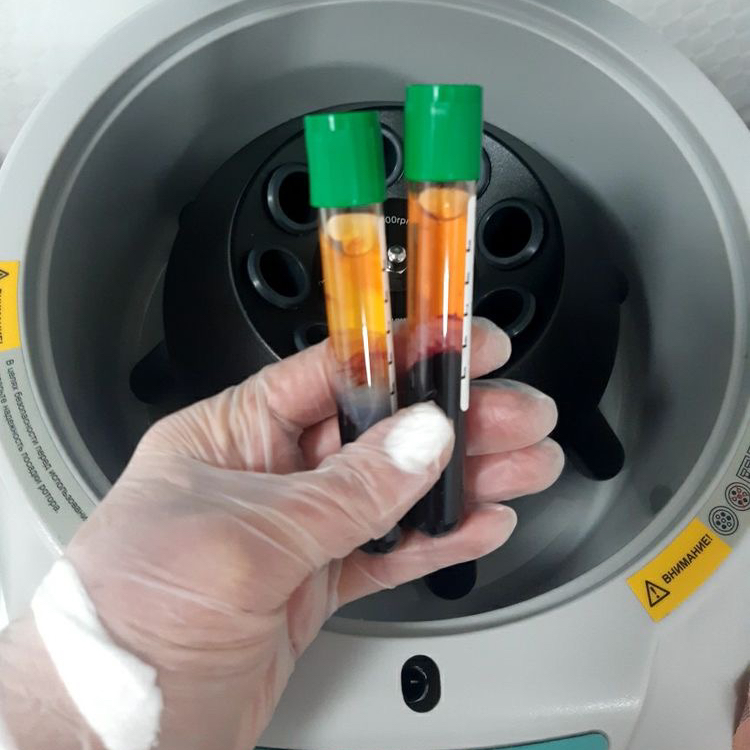 Плазмолифтинг