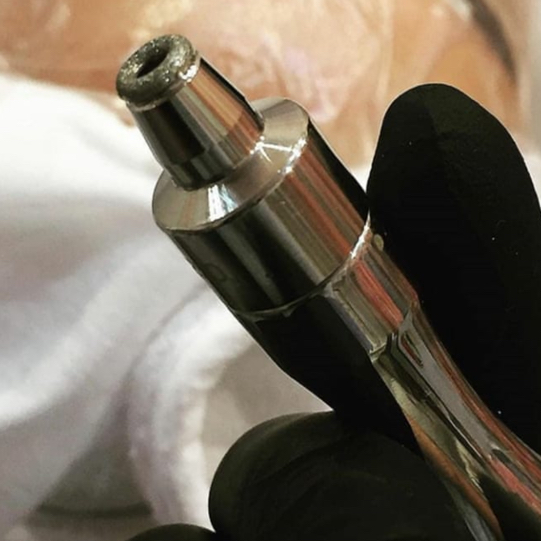 Вакуумная чистка лица  Микродермабразия