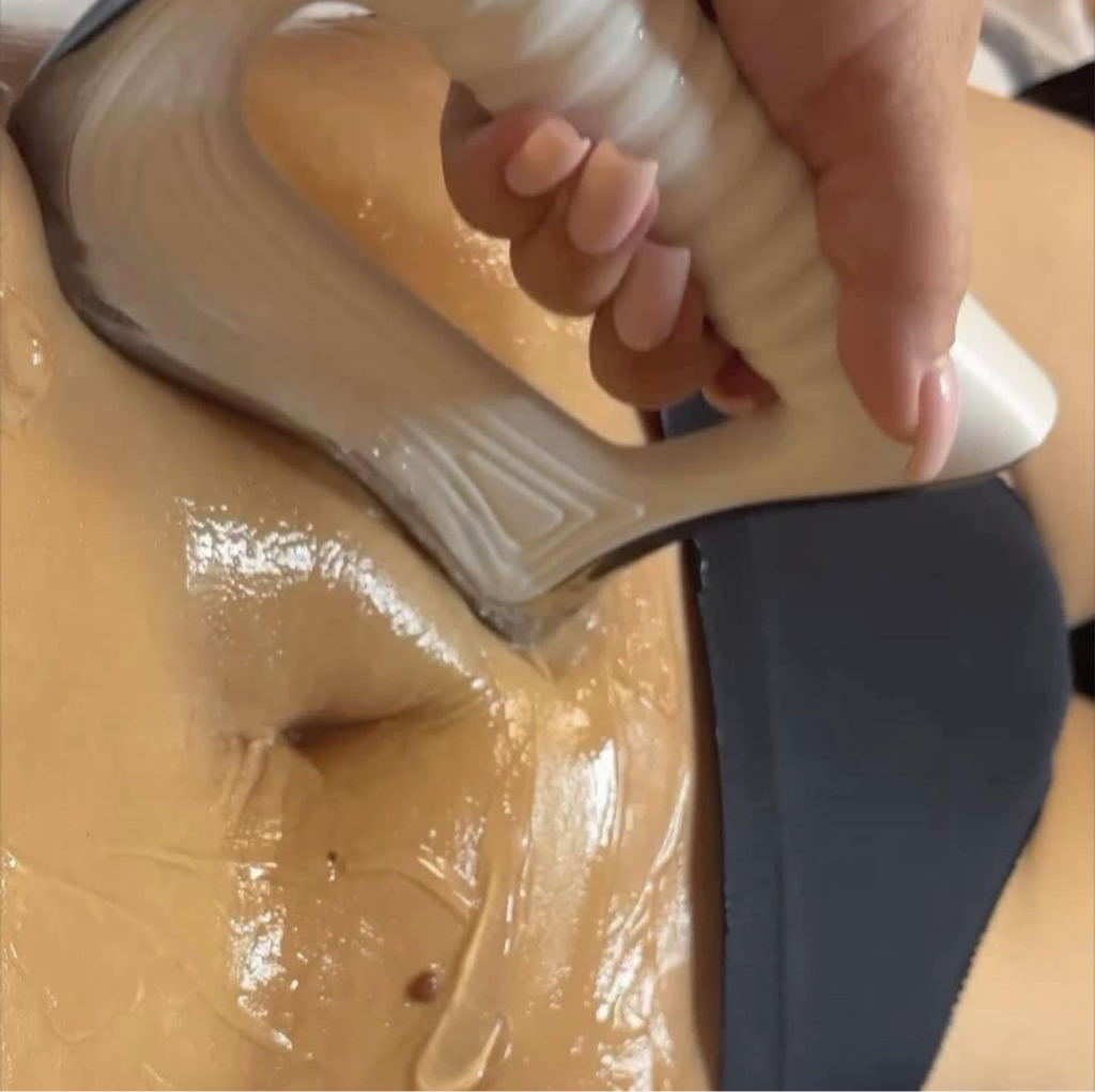 Индиба тело