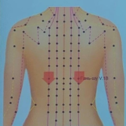 DVL Extra Mesopharm Липолитик 4мл