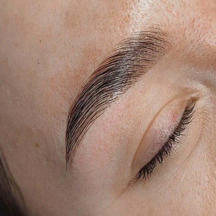 лами бровей/ Brow lift