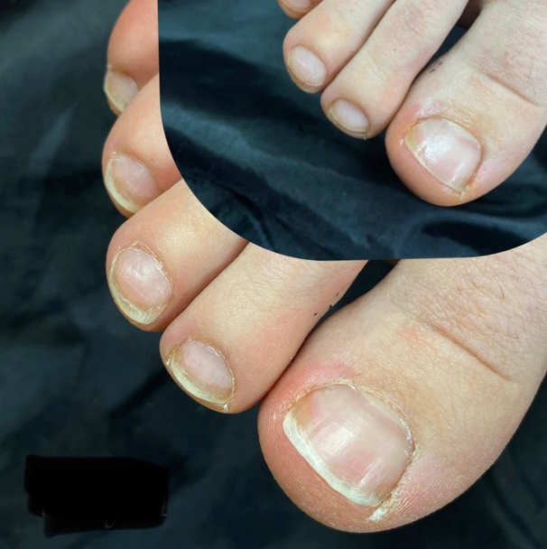 Контроль длины