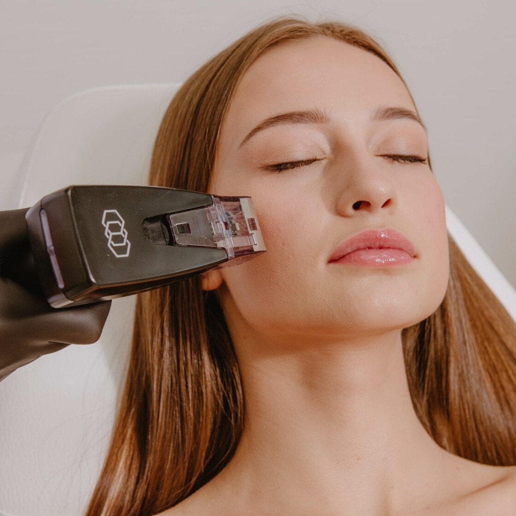 RF- лифтинг Лицо+ зона век (игольчатый).