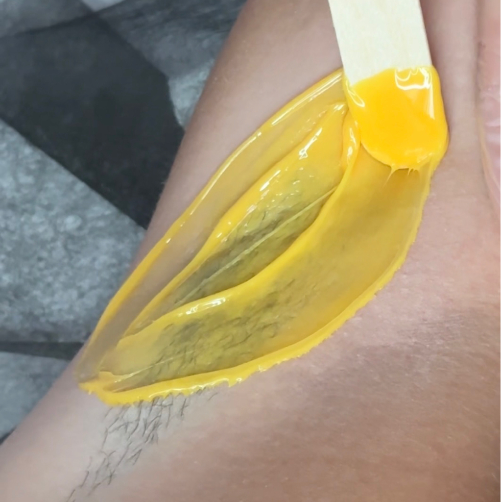 Депиляция подмышек