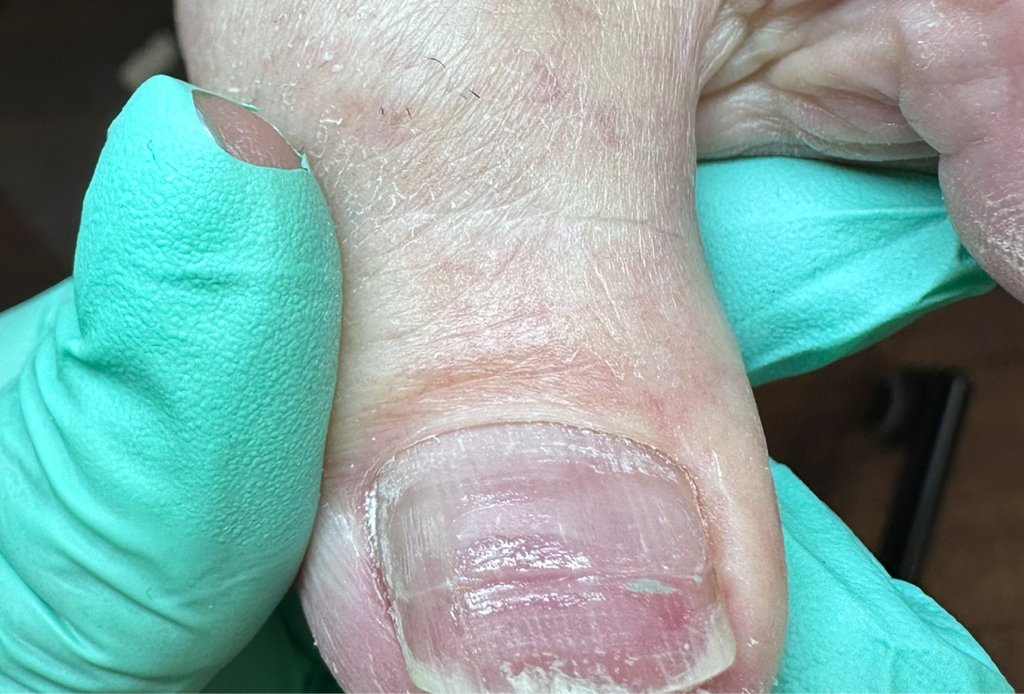 Постановка LS системы