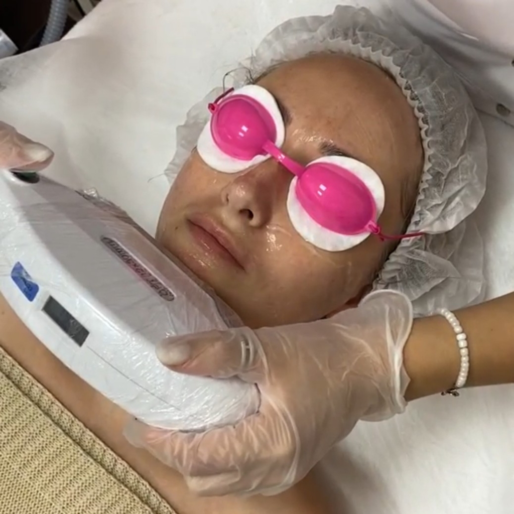 Подбородок