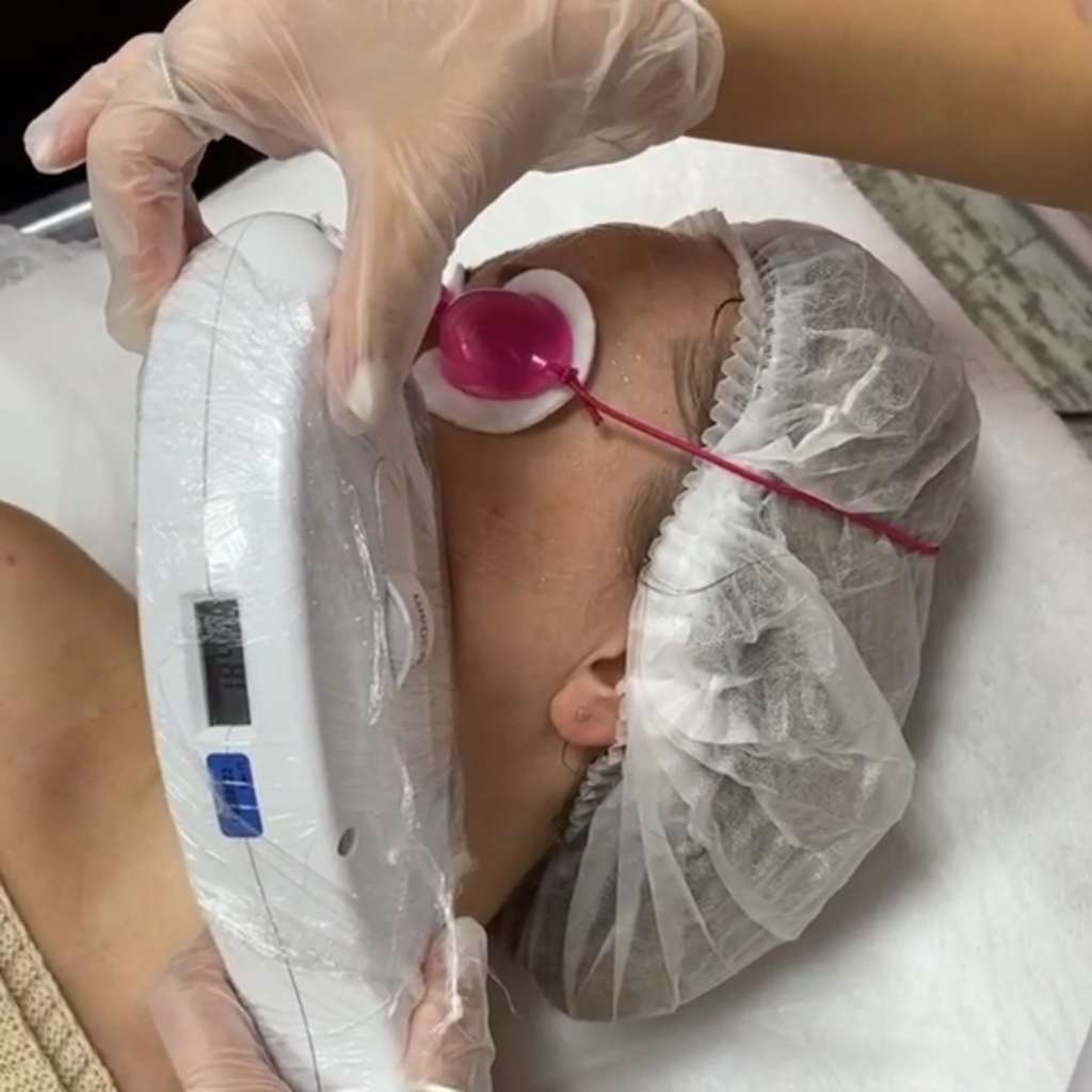 Верхняя губа