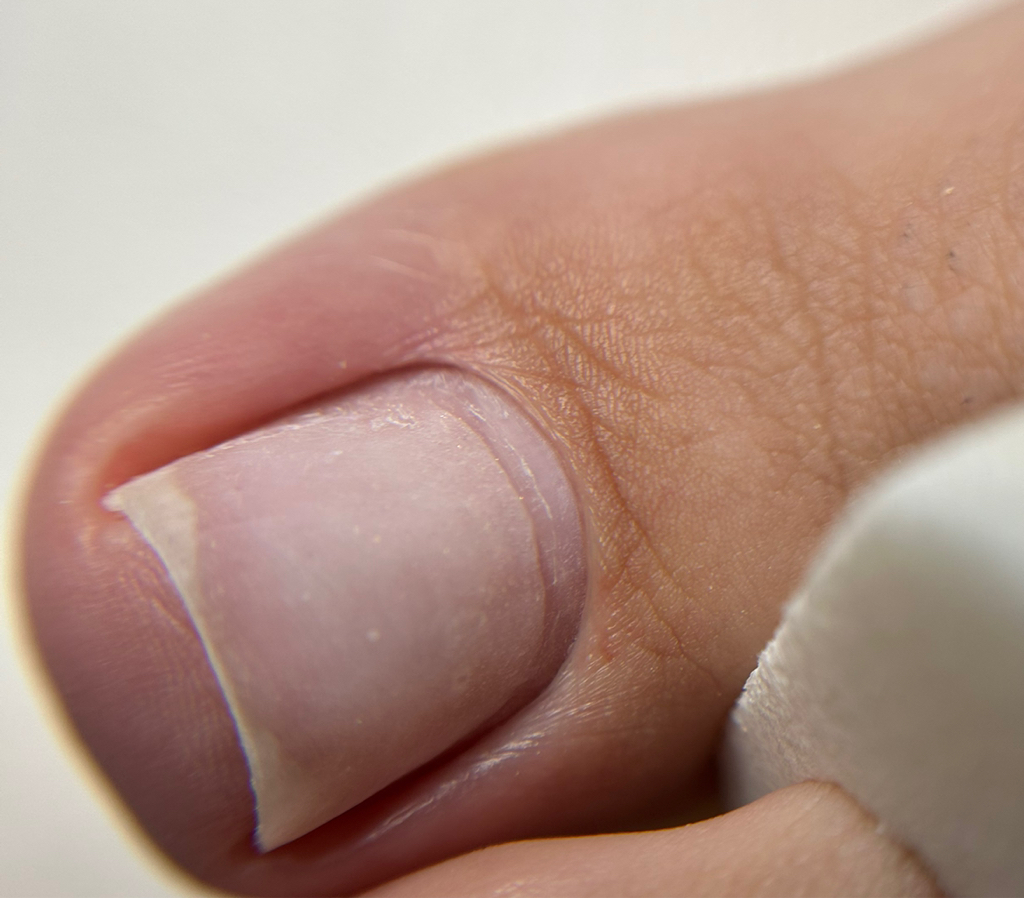 Педикюр только пальчики