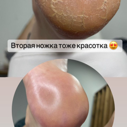 Педикюр смарт 2.0