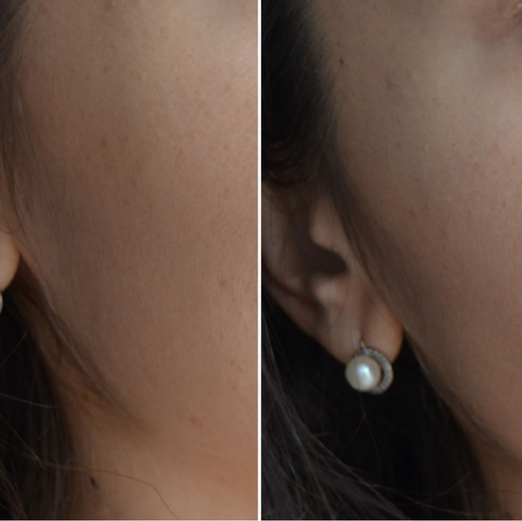 Бакенбарды