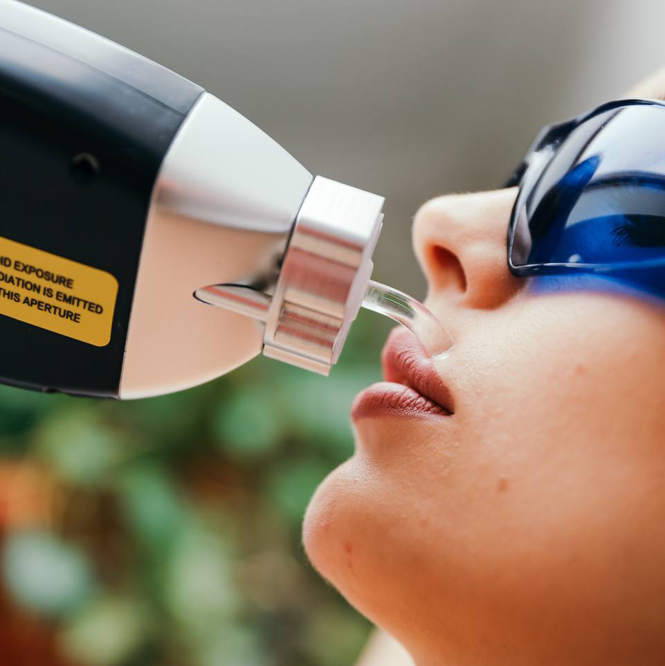 Зона S, XS  (Зона лица, пальцы рук или ног, линия живота, ареолы, подмышки)   *цена первого посещения