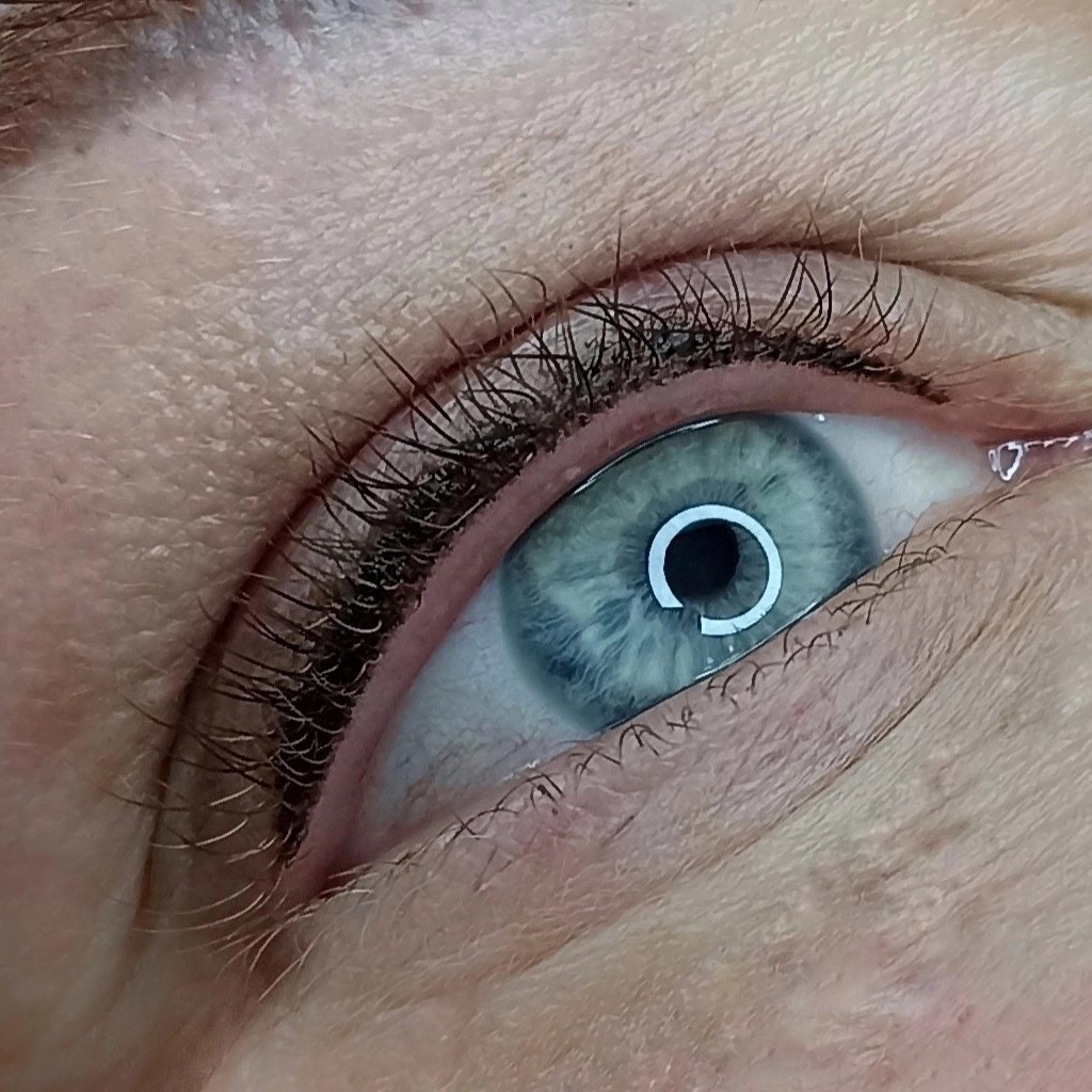 Межресничка