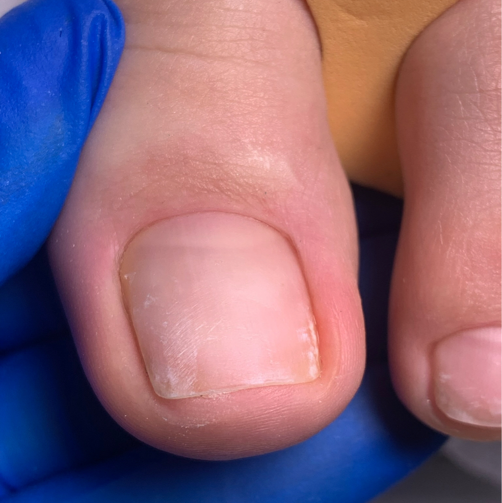 Педикюр комбинированный/ аппаратный