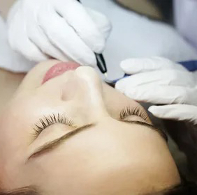 Электроэпиляция лицо (1 час)