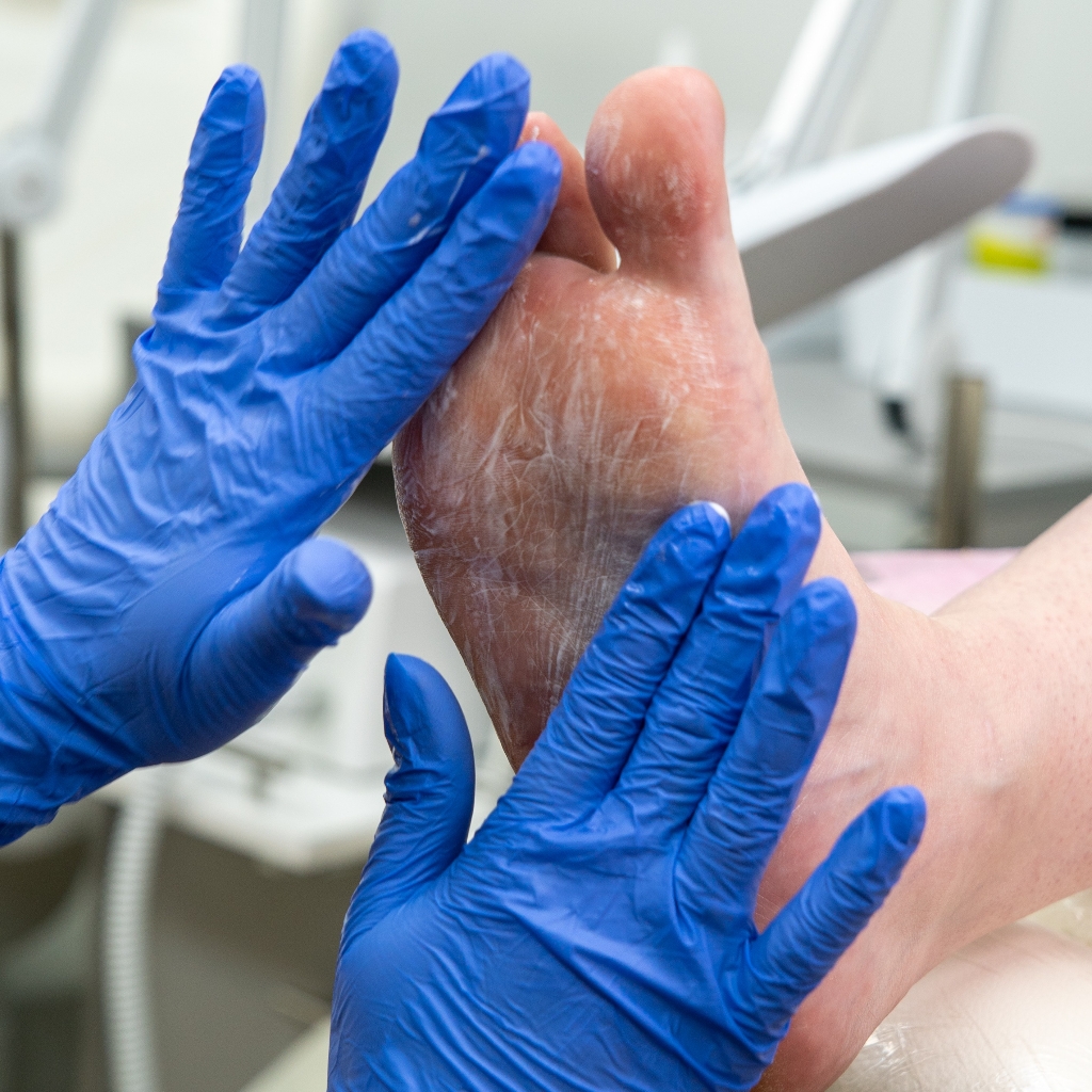 Педикюр гигиенический