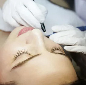 Электроэпиляция лицо (1,5 часа)