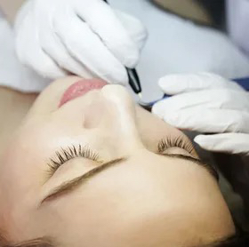 Электроэпиляция лицо (10 мин)