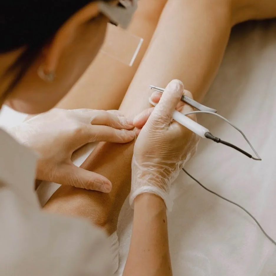 Электроэпиляция тело (15 мин)