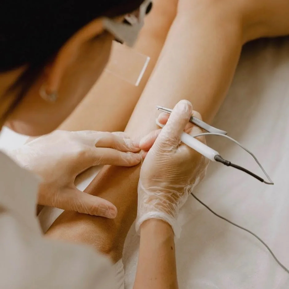 Электроэпиляция тело (1 час)