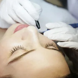 Электроэпиляция лицо (30 мин)