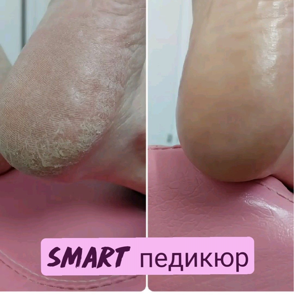Педикюр/Smart (всё включено)
