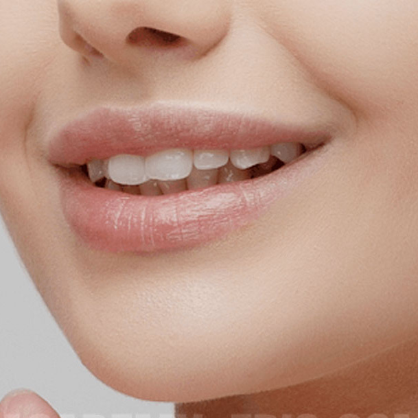 Подбородок нитью