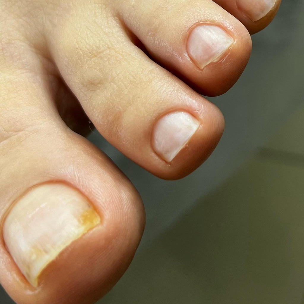 Педикюр(пальчики без покрытия)