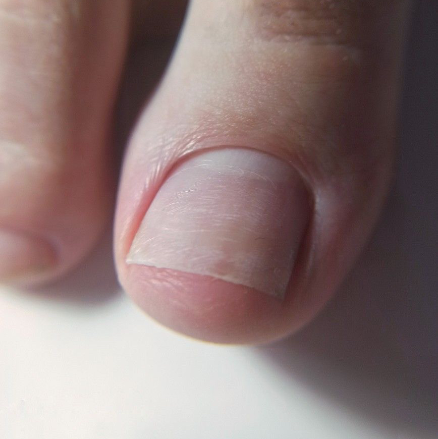 Педикюр без покрытия